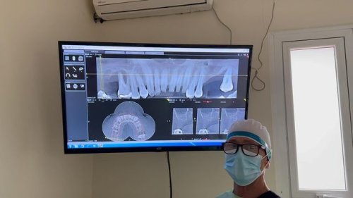 Video post from dr.andrespriotti.