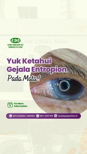 PostPhoto