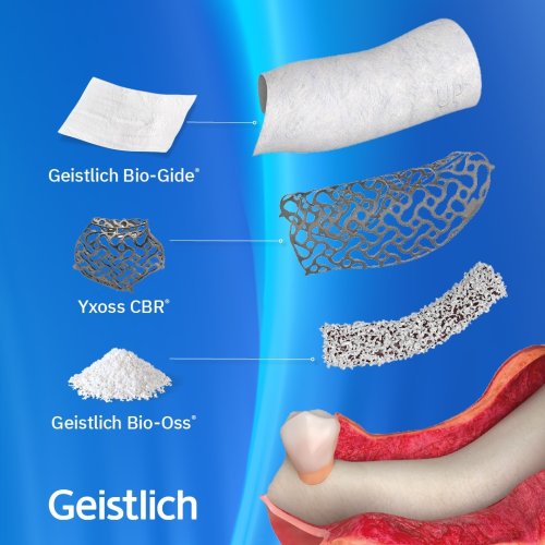 Photo post from geistlich_north_america.