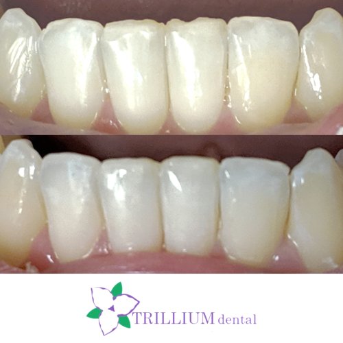 Photo post from trilliumdental.