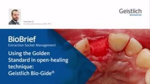 Video post from geistlich_north_america.