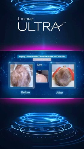 Video post from kerafactor.