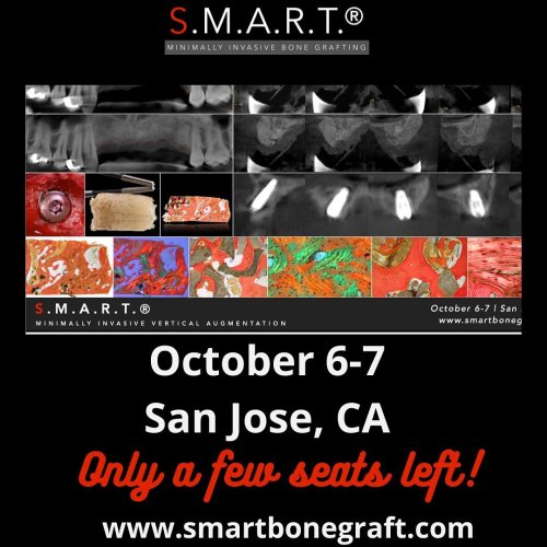 Photo post from smartbonegraft.