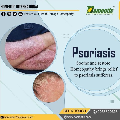 Photo post from homeotic_international.