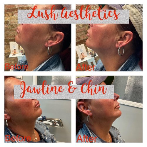 Photo post from lushaestheticsky.