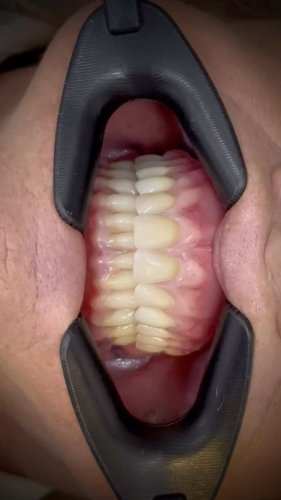 Video post from dr.andrespriotti.