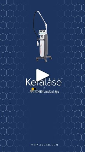 Video post from kerafactor.