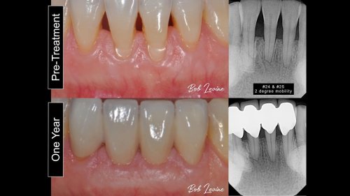 Carousel post from dr.robertlevine.