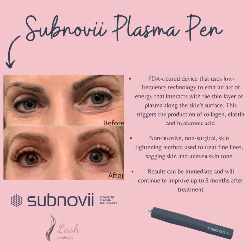 Photo post from lushaestheticsky.
