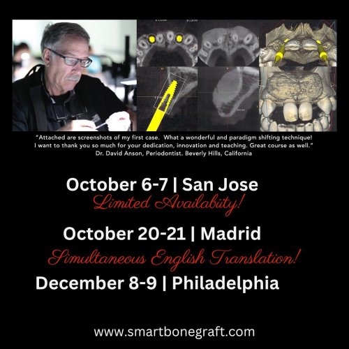 Photo post from smartbonegraft.