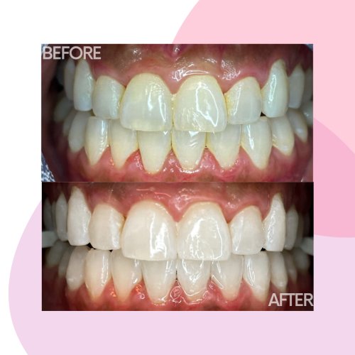 Photo post from trilliumdental.