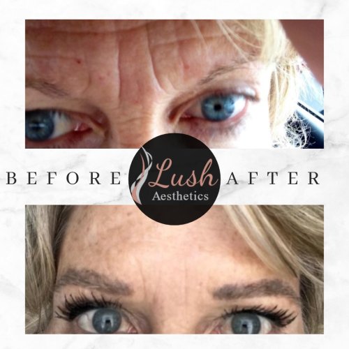Photo post from lushaestheticsky.