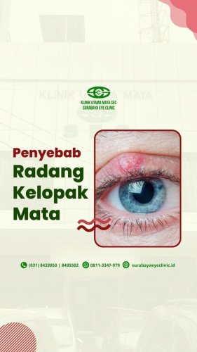 PostPhoto