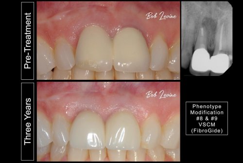 Carousel post from dr.robertlevine.