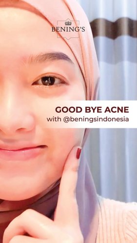 PostPhoto
