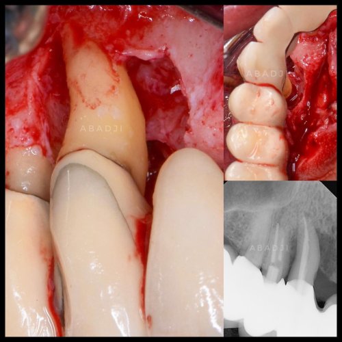 Carousel post from abadjispecialistdentistry.