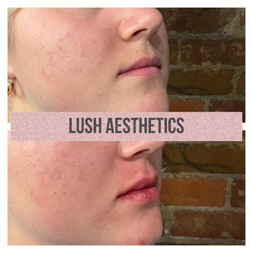 Photo post from lushaestheticsky.