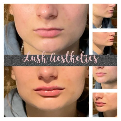 Photo post from lushaestheticsky.