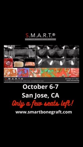 Video post from smartbonegraft.