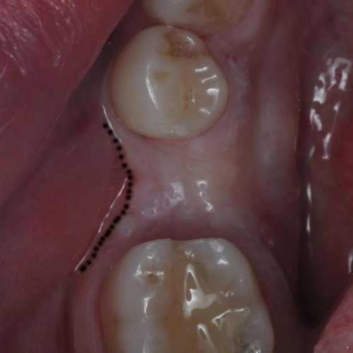 Carousel post from dr.mohammedalrubaie.