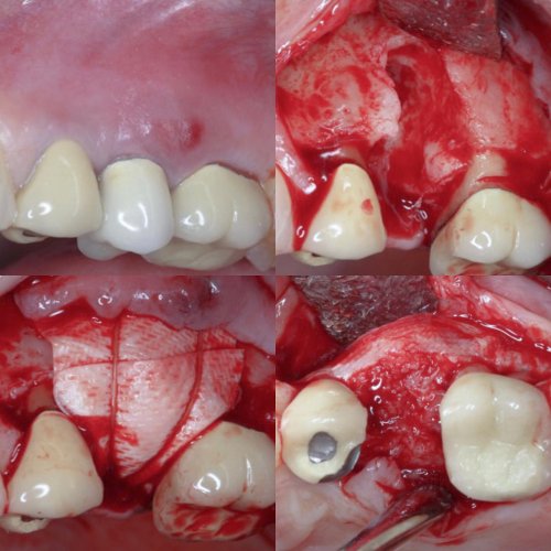 Photo post from fienodontics.
