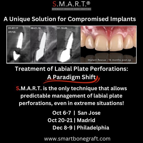 Photo post from smartbonegraft.