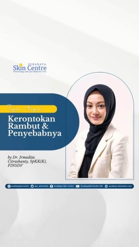 PostPhoto