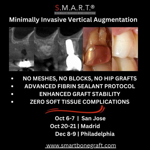 Photo post from smartbonegraft.