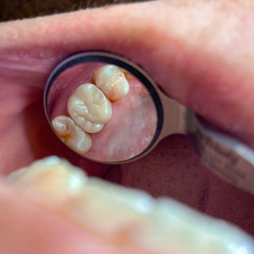 Photo post from trilliumdental.