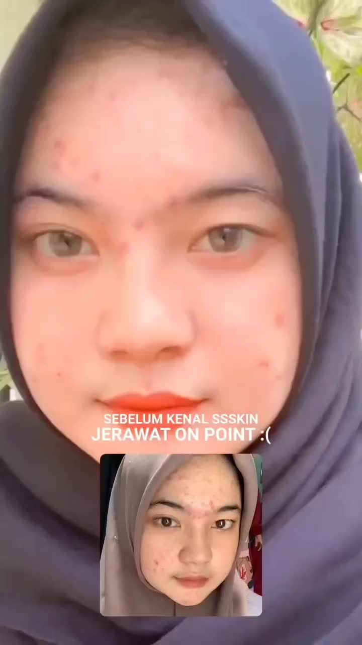 PostPhoto