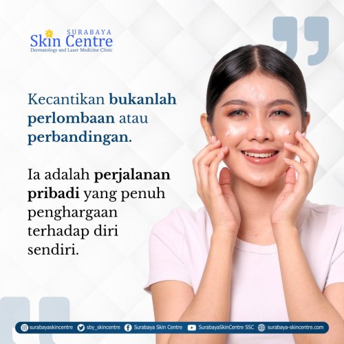 PostPhoto
