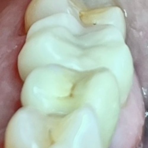Photo post from trilliumdental.