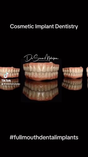 Video post from drsionamotufau.