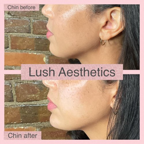 Photo post from lushaestheticsky.