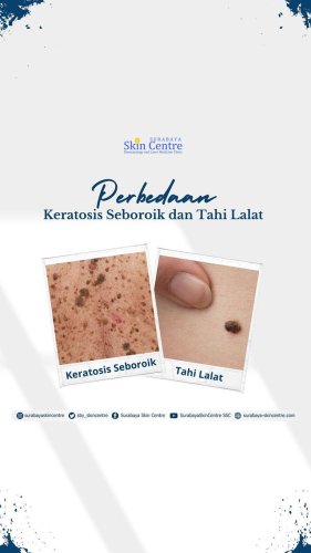 PostPhoto