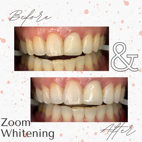 Photo post from trilliumdental.