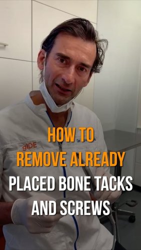 Video post from gidedental.