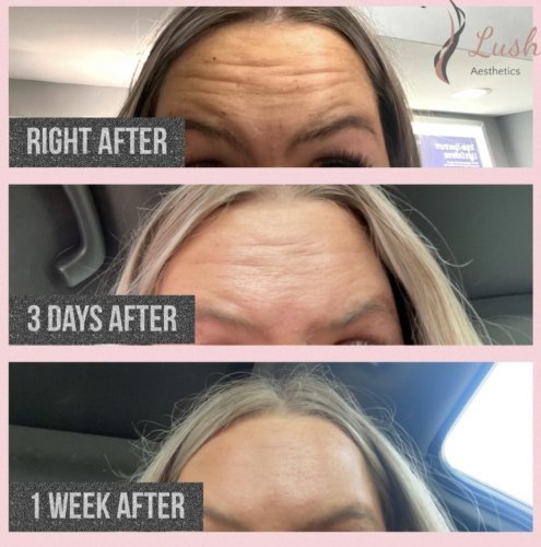 Photo post from lushaestheticsky.