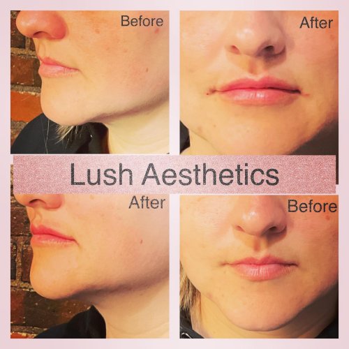 Photo post from lushaestheticsky.