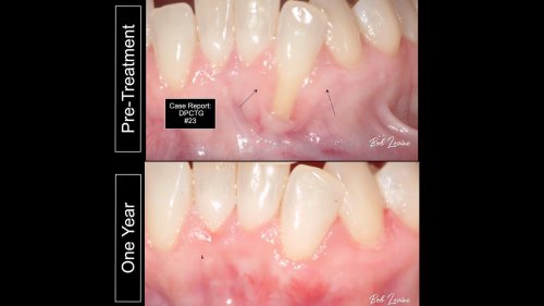 Carousel post from dr.robertlevine.