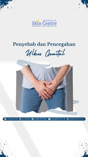 PostPhoto