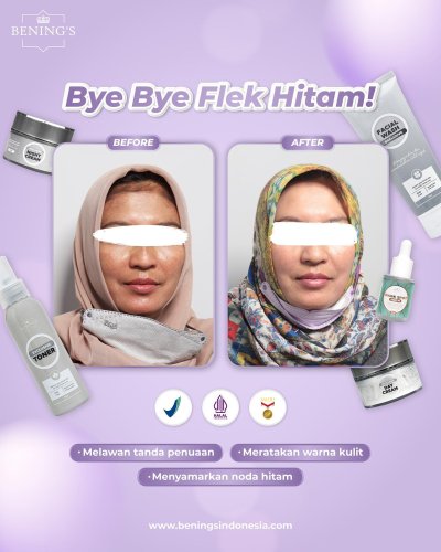 PostPhoto