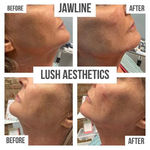 Photo post from lushaestheticsky.