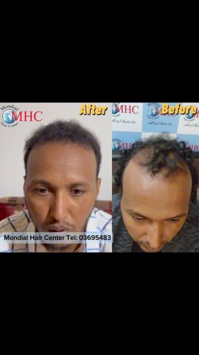 Video post from mondialhaircenter.