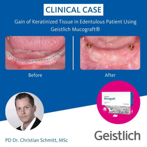 Photo post from Geistlich Biomaterials - North America.
