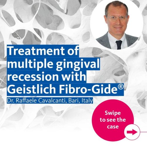 Carousel post from Geistlich Biomaterials - North America.