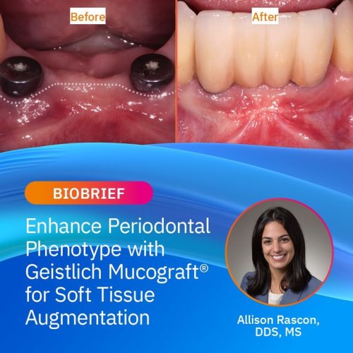 Carousel post from Geistlich Biomaterials - North America.