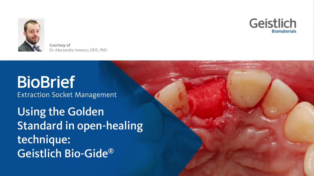 Video post from Geistlich Biomaterials - North America.