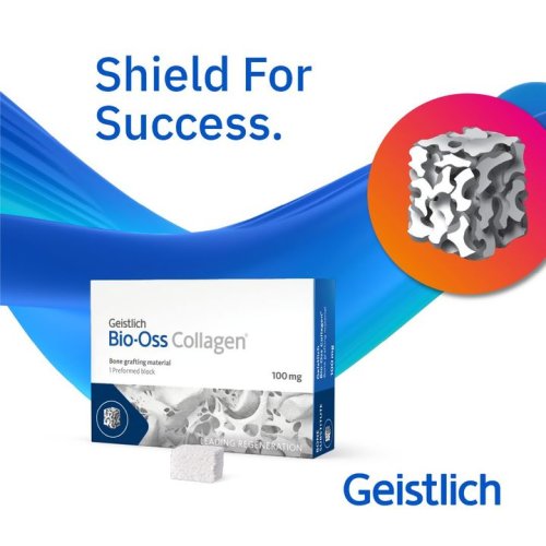 Carousel post from Geistlich Biomaterials - North America.