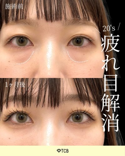 Carousel post from tcb_tomita_ryo.